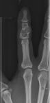 5 NMSP Circulation A21 - Bone case B6a.jpg